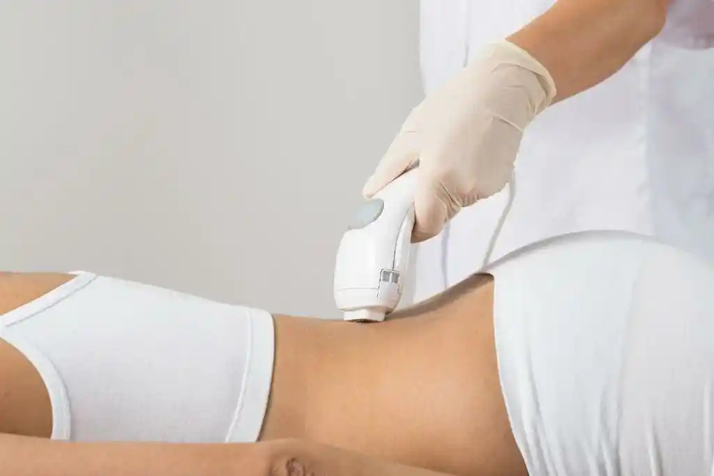 Laser Back Hair Removal Cost – Affordable solutions for smooth, hair-free back with lasting results.