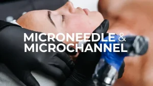 Microneedling vs Microchanneling benefits for skin care