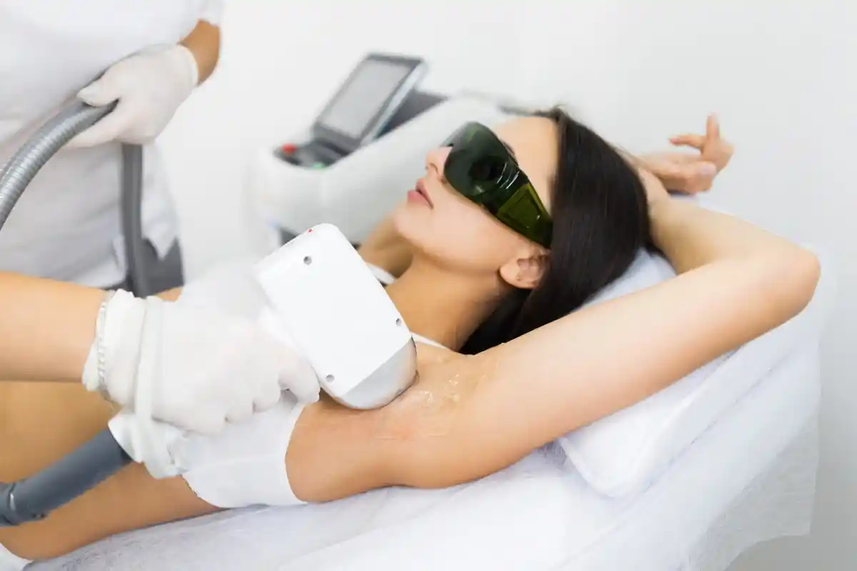 laser hair removal armpits