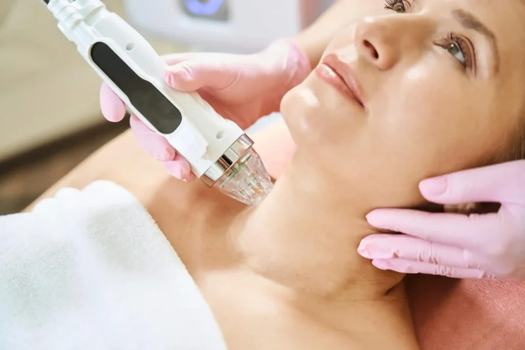 Does RF microneedling hurt – patient during treatment session