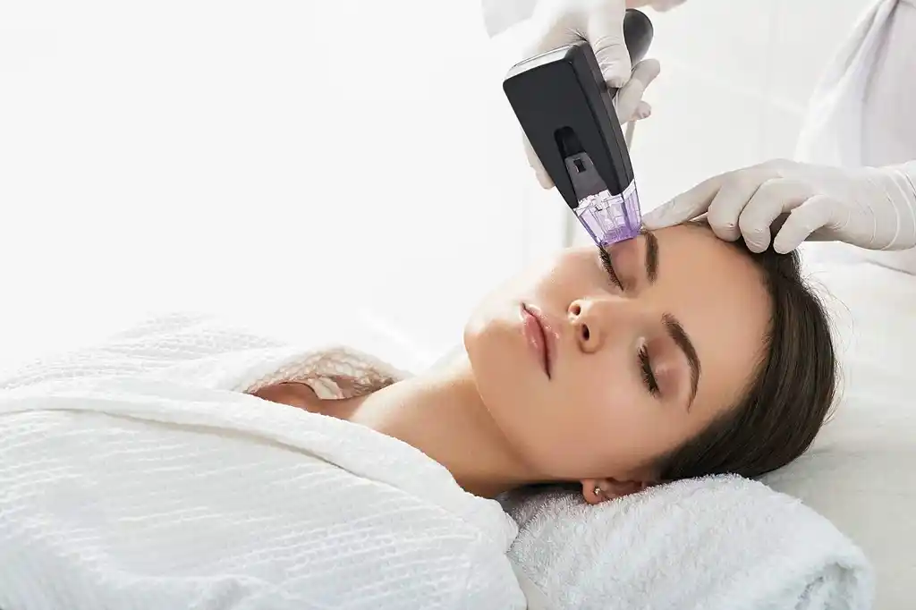 How long microneedling results last and what affects duration