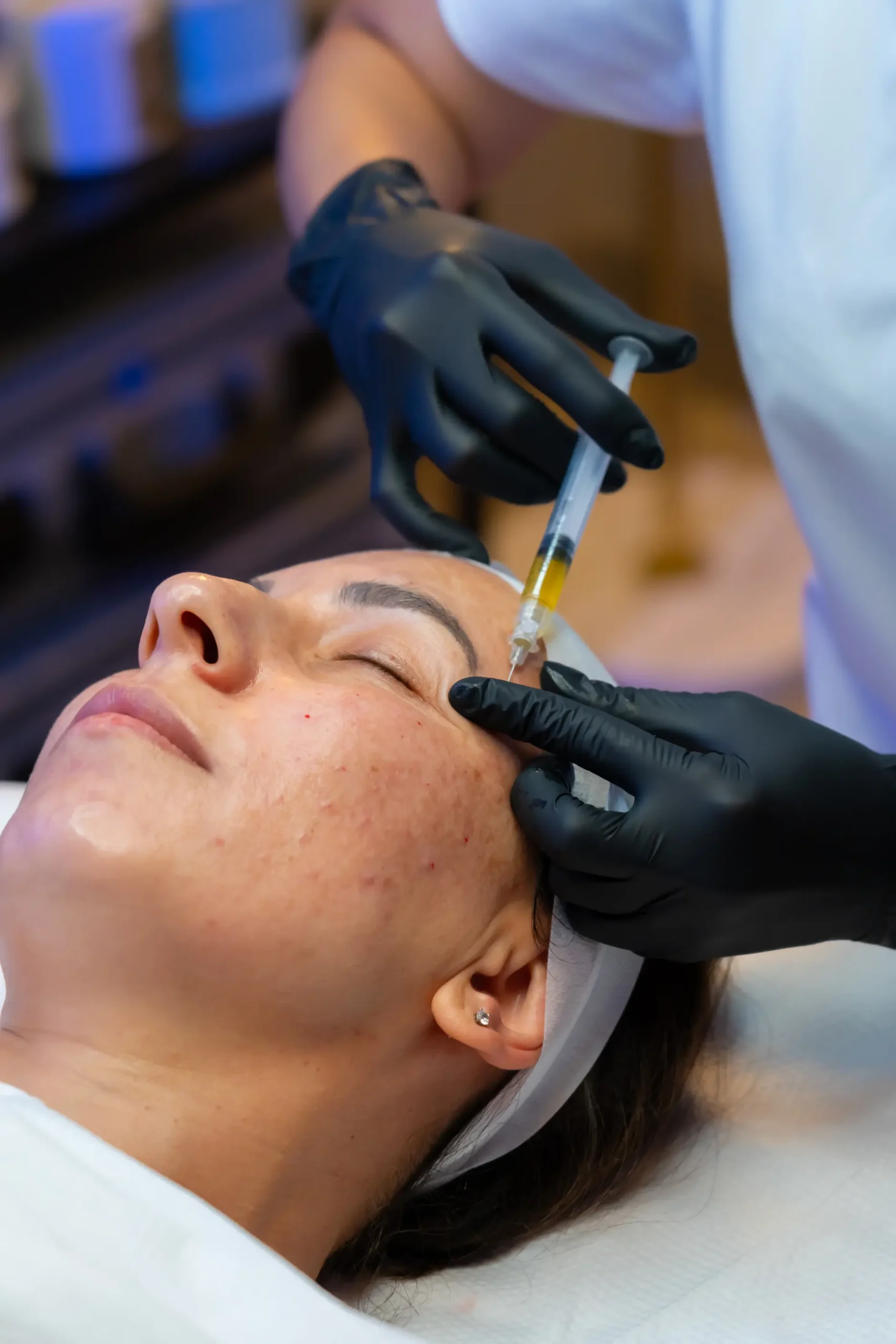 Close-up of a minimally invasive injection technique used in vein and skin treatments at AryNova Aesthetics